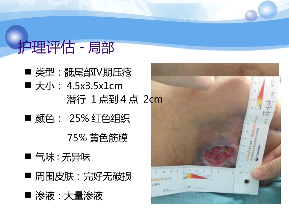 一例糖尿病合并骶尾部压疮患者的护理_第7页