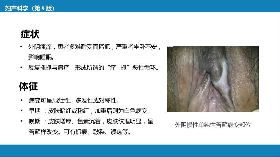 外阴色素减退性疾病._第8页
