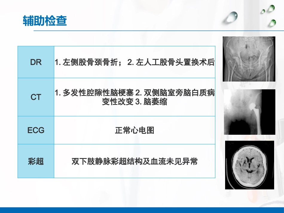 一例脑梗塞合并股骨头置换术后康复期患者的个案护理_第6页