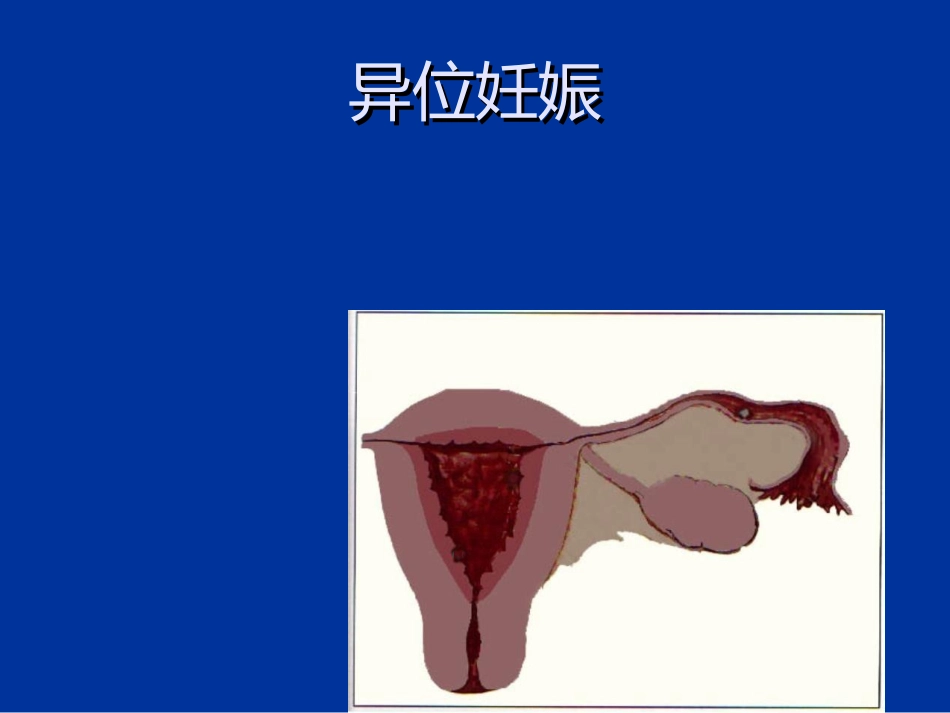 异位妊娠失血性休克的急救与护理_第3页