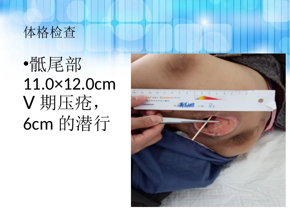 重度压疮个案护理查房_第8页