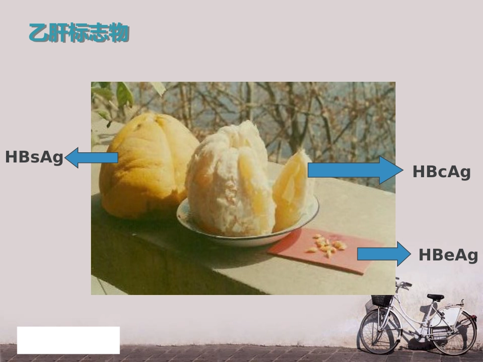妊娠合并乙肝--PPT课件_第5页