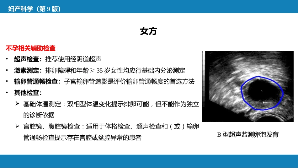 不孕症与辅助生殖技术PPT_第15页
