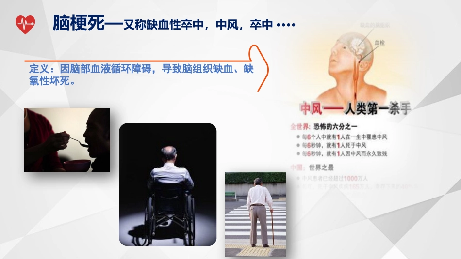 一例脑梗死偏瘫合并吞咽障碍患者的个案护理_第4页