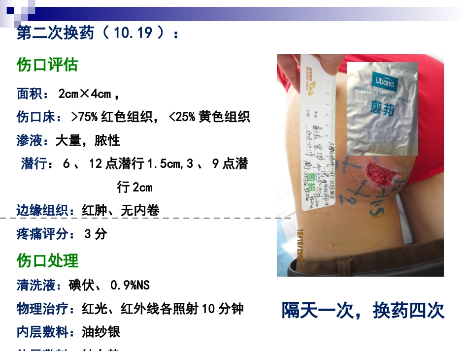 一例臀部巨大脓肿切开引流患者的个案护理_第10页