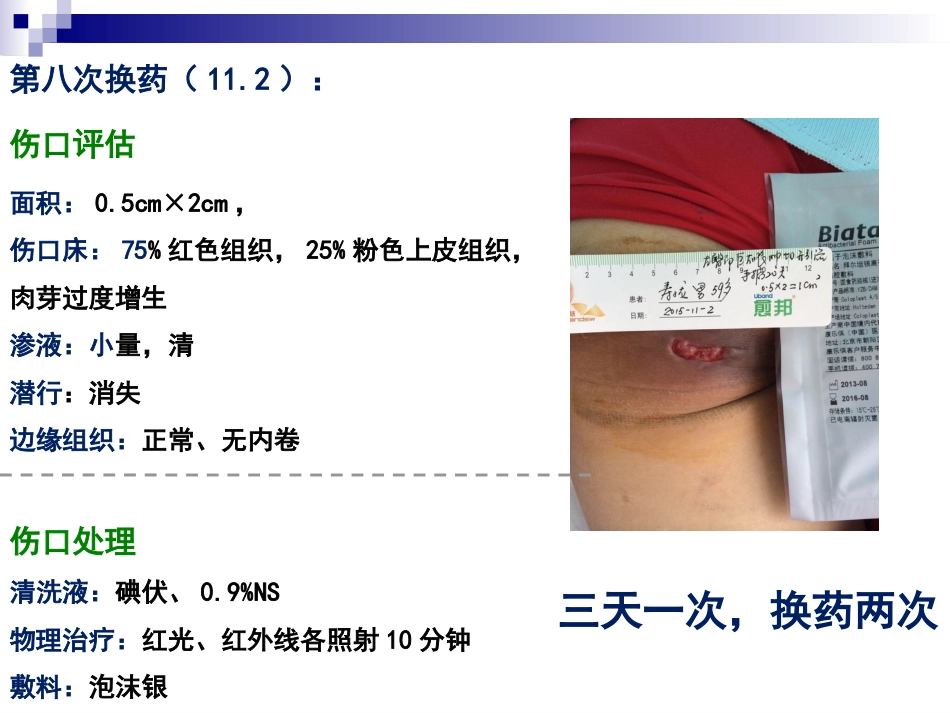 一例臀部巨大脓肿切开引流患者的个案护理_第12页