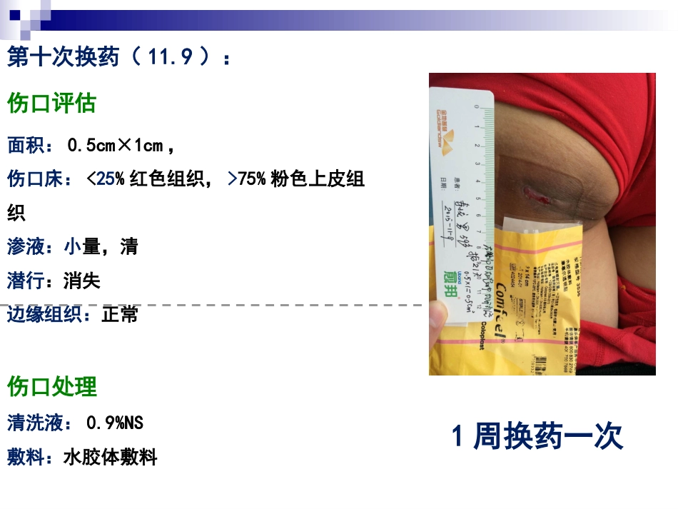 一例臀部巨大脓肿切开引流患者的个案护理_第13页
