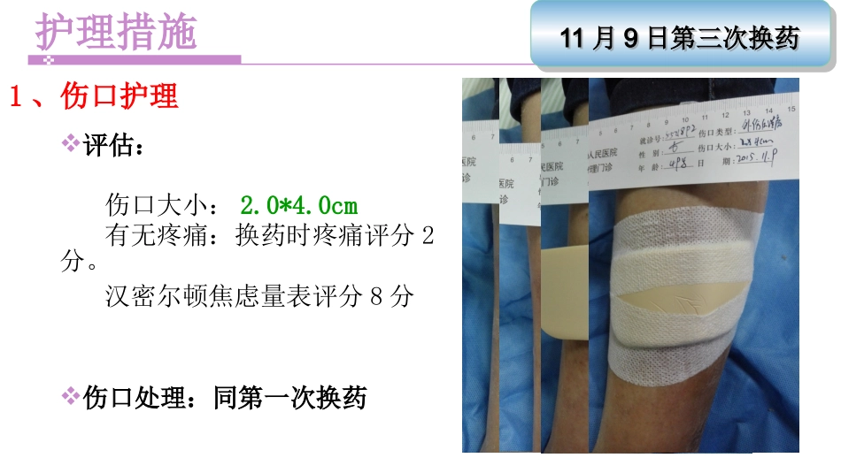 一例左下肢软组织挫裂伤患者护理_第10页