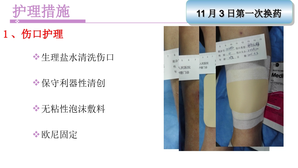 一例左下肢软组织挫裂伤患者护理_第8页