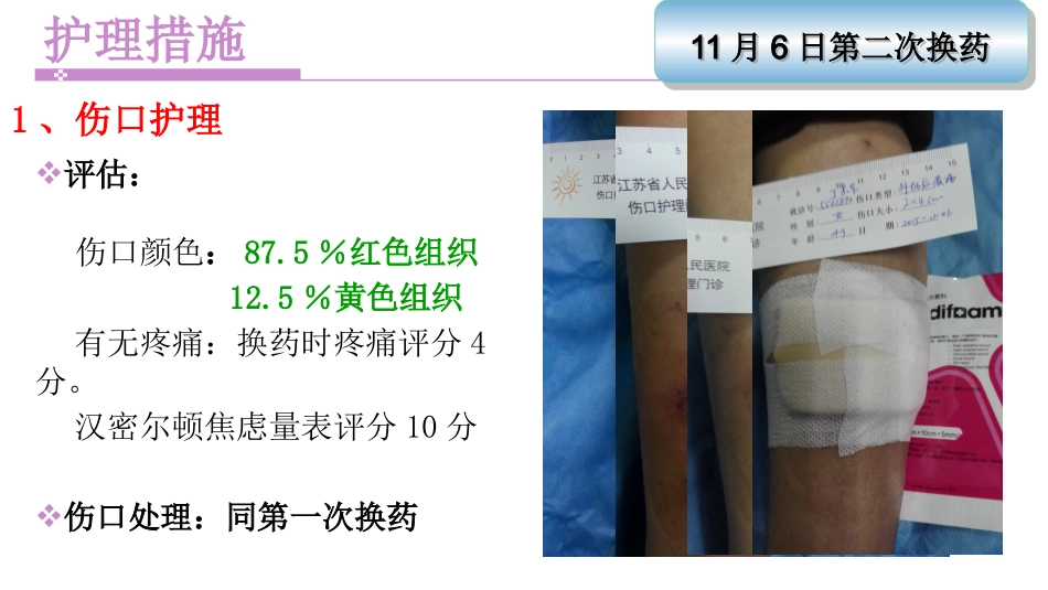 一例左下肢软组织挫裂伤患者护理_第9页