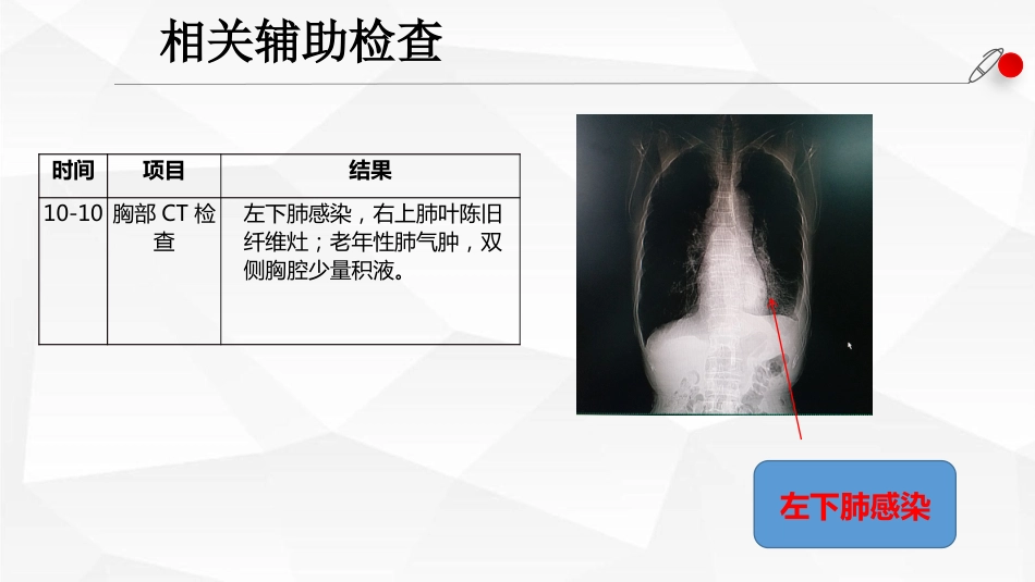 一例AECOPD患者肺康复指导的个案跟进_第15页