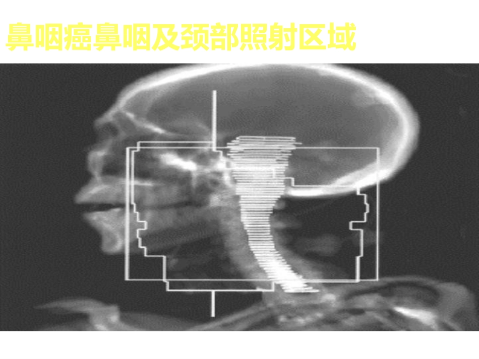 吞咽障碍个案护理_第8页