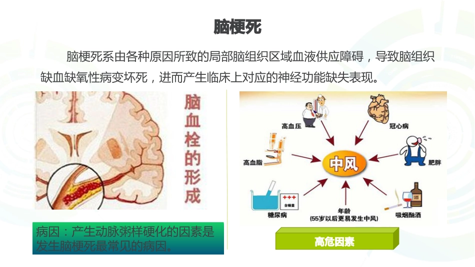 一例多发性脑梗死患者康复护理_第4页