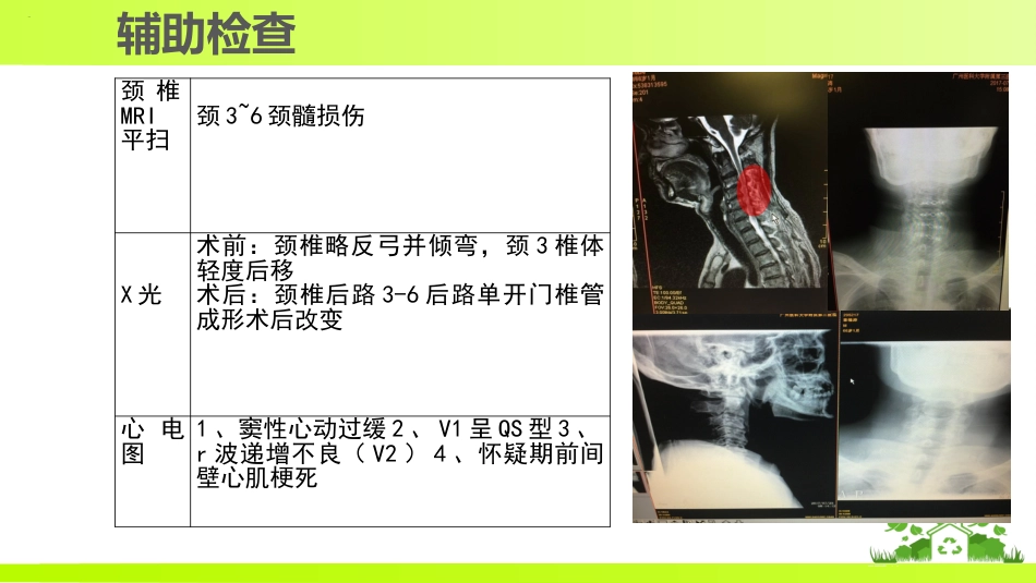 一例颈髓损伤伴不完全性瘫痪患者的个案护理_第11页