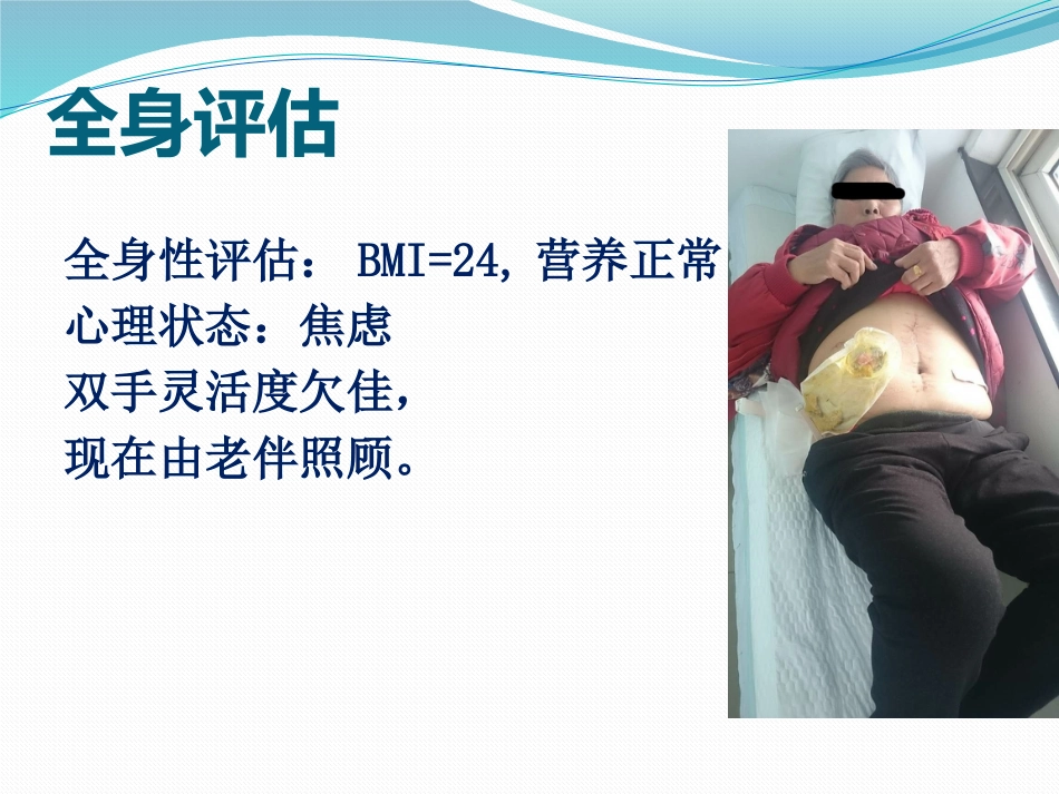 一例回肠造口周围皮肤并发症患者护理_第5页