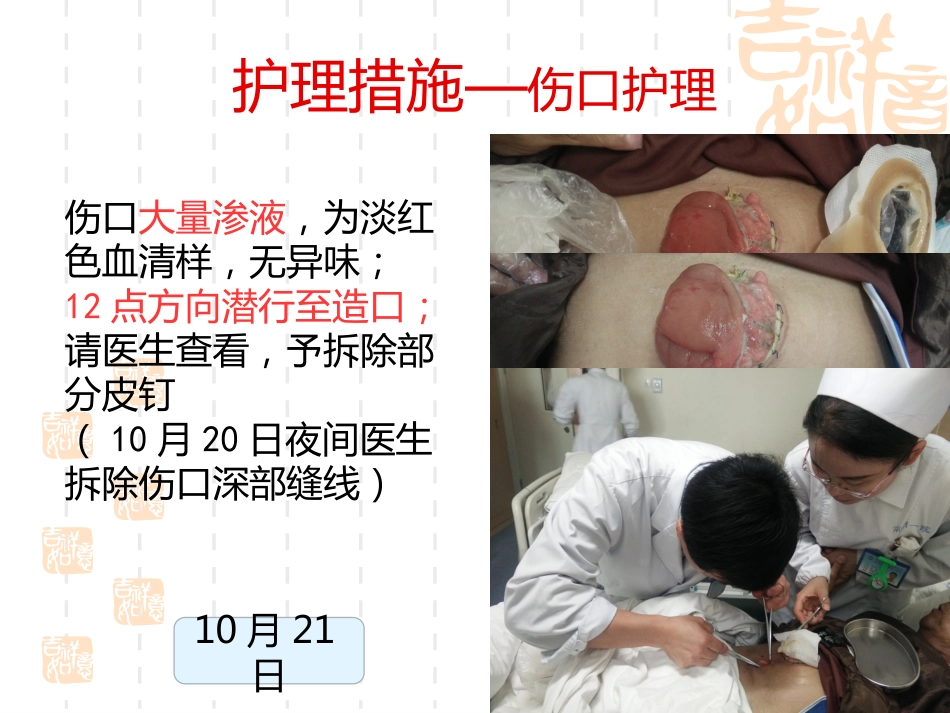一例横结肠造口术后腹部切口裂开患者的护理_第11页
