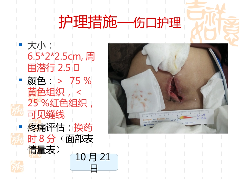 一例横结肠造口术后腹部切口裂开患者的护理_第12页