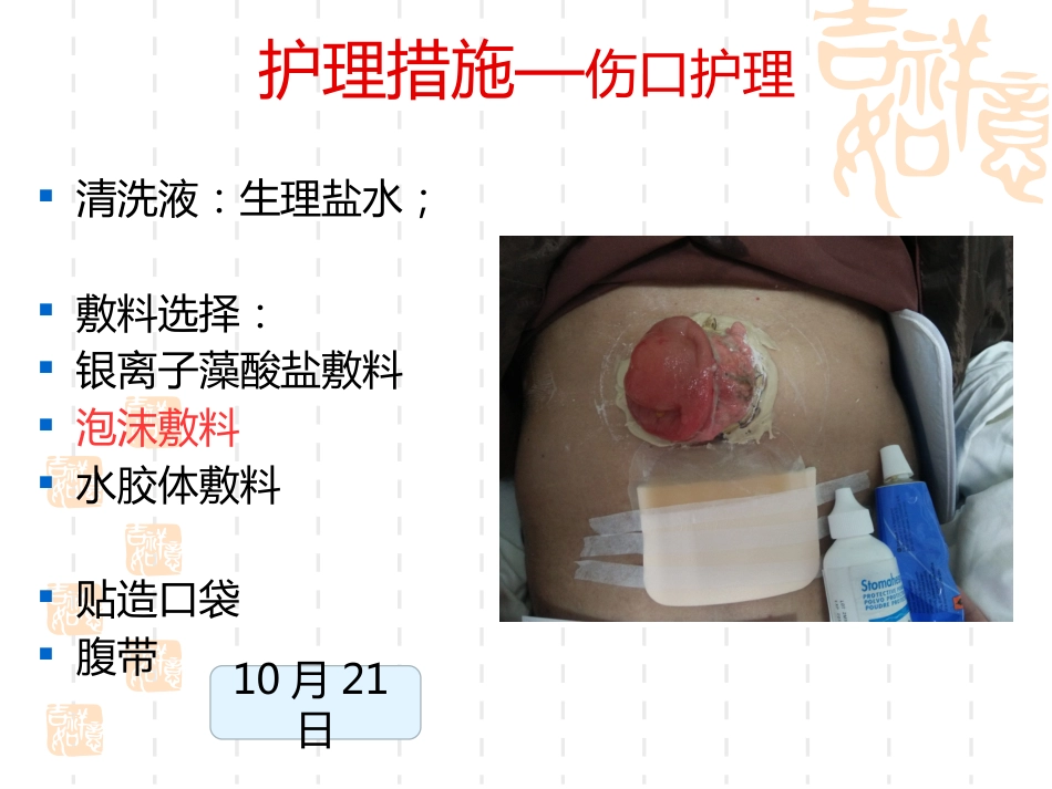 一例横结肠造口术后腹部切口裂开患者的护理_第13页