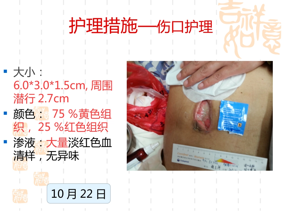 一例横结肠造口术后腹部切口裂开患者的护理_第15页