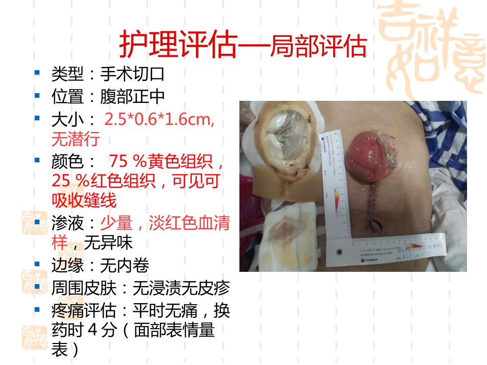 一例横结肠造口术后腹部切口裂开患者的护理_第5页