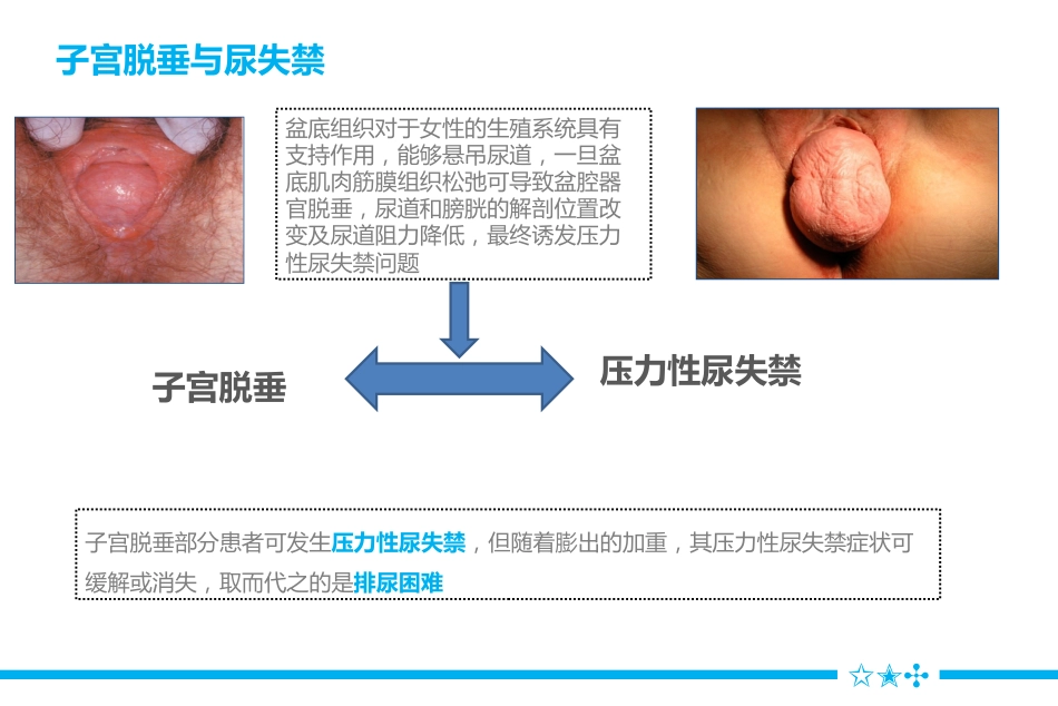 一例压力性尿失禁患者术后个案护理_第7页