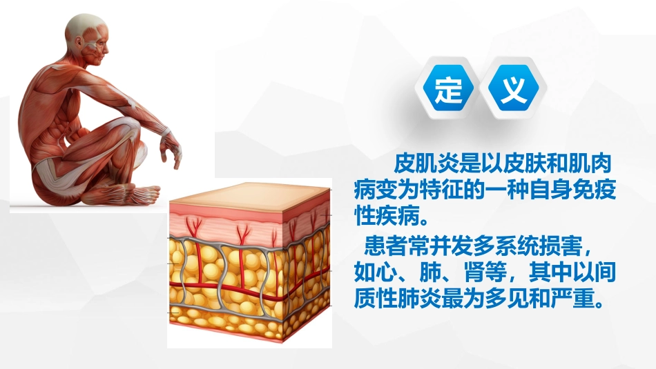 一例皮肌炎合并间质性肺炎_第4页
