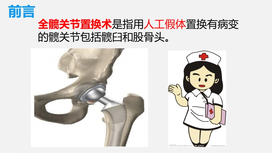 一例全髋关节置换术患者的围手术期护理_第3页