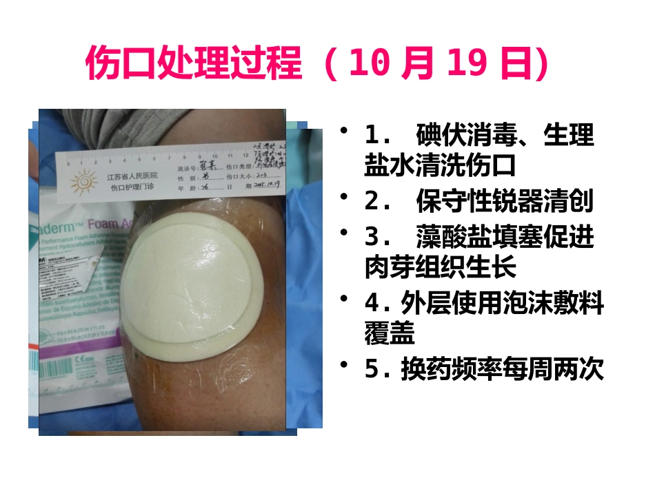 一例缝线伤口延迟愈合患者的护理_第10页