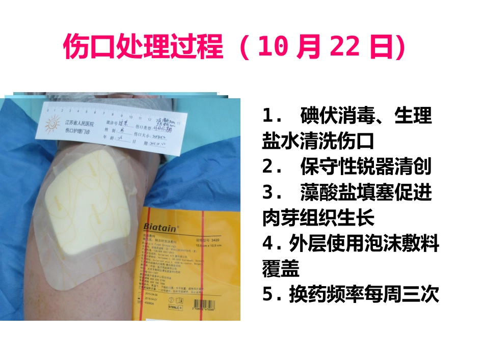 一例缝线伤口延迟愈合患者的护理_第12页