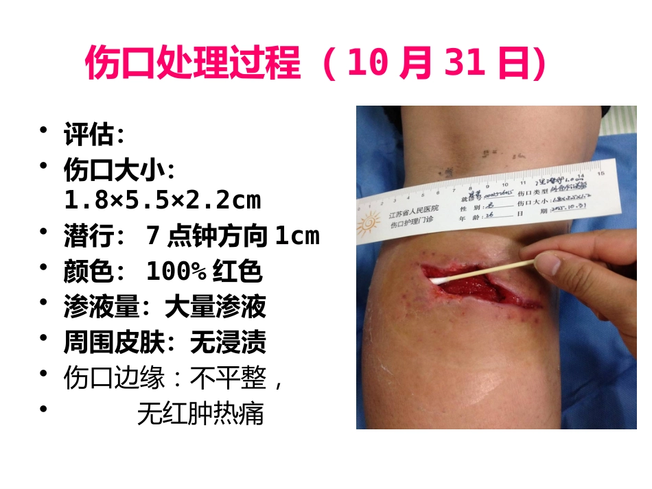 一例缝线伤口延迟愈合患者的护理_第13页