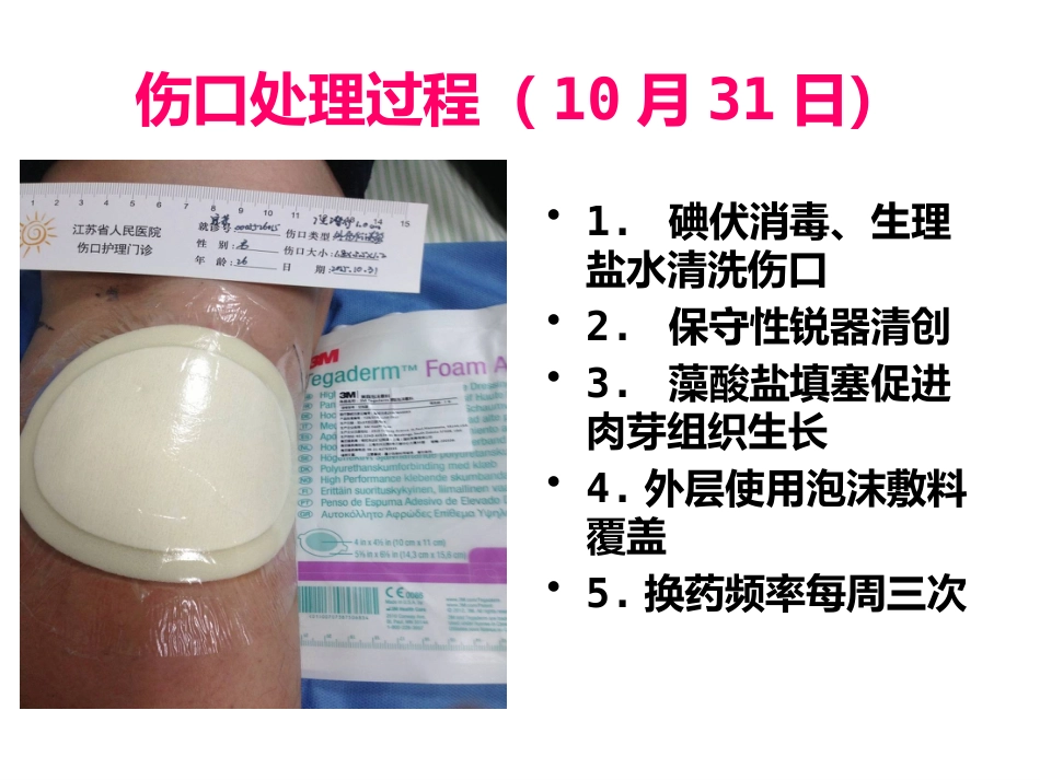 一例缝线伤口延迟愈合患者的护理_第14页
