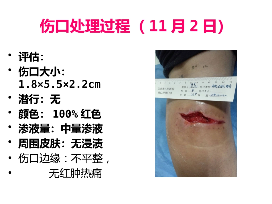 一例缝线伤口延迟愈合患者的护理_第15页