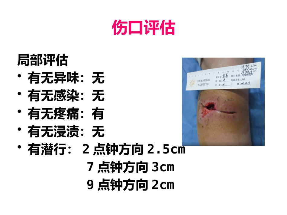一例缝线伤口延迟愈合患者的护理_第7页