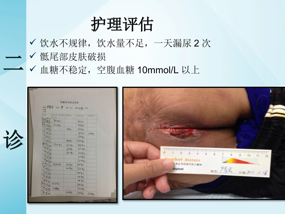 一例截瘫伴充盈性尿失禁患者的居家护理_第10页