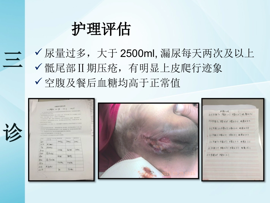 一例截瘫伴充盈性尿失禁患者的居家护理_第14页