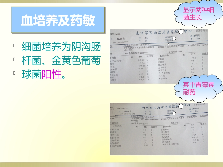 一例糖尿病足感染伴肌腱坏死护理_第7页