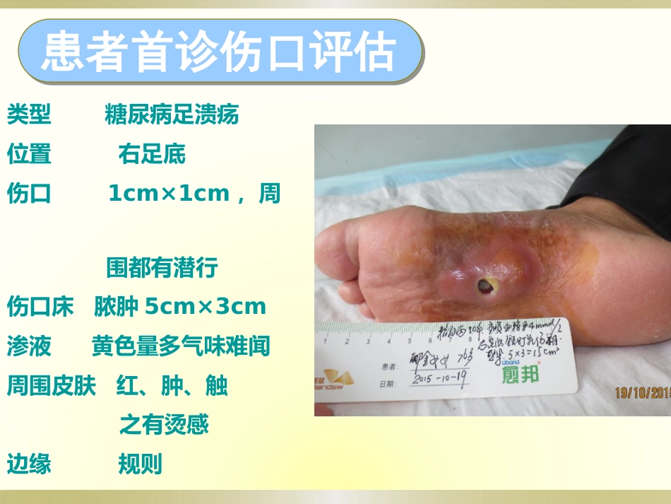 一例糖尿病足感染伴肌腱坏死护理_第8页