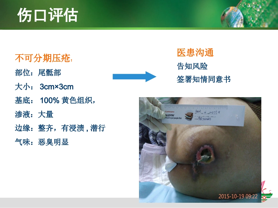 负压治疗一例合并感染Ⅳ期压疮患者的护理体会_第6页