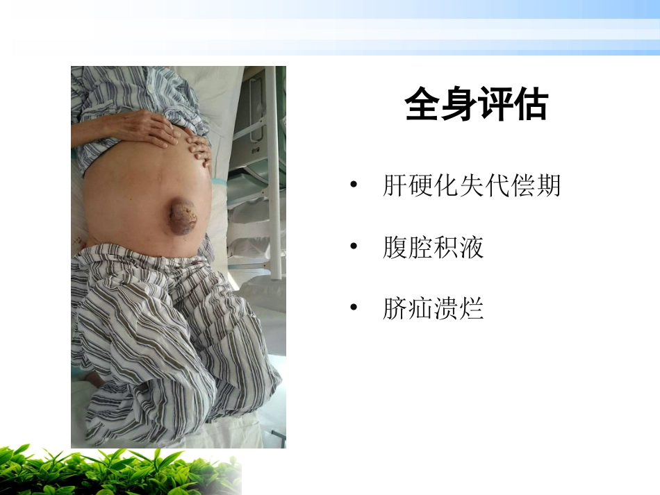 一例肝硬化腹水伴脐疝破溃患者的护理_第6页