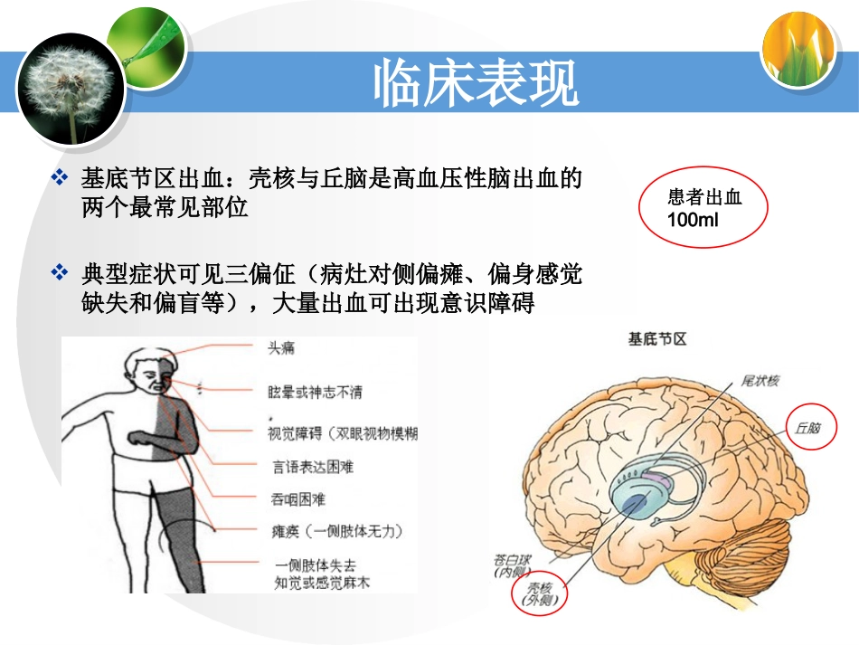 一例脑出血恢复期合并气管切开术后患者的个案护理_第4页
