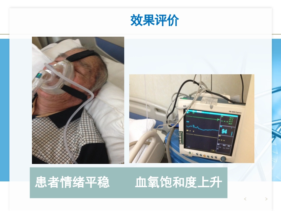 NPPV人机对抗个案护理_第12页