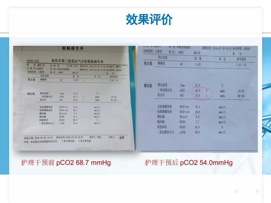 NPPV人机对抗个案护理_第13页