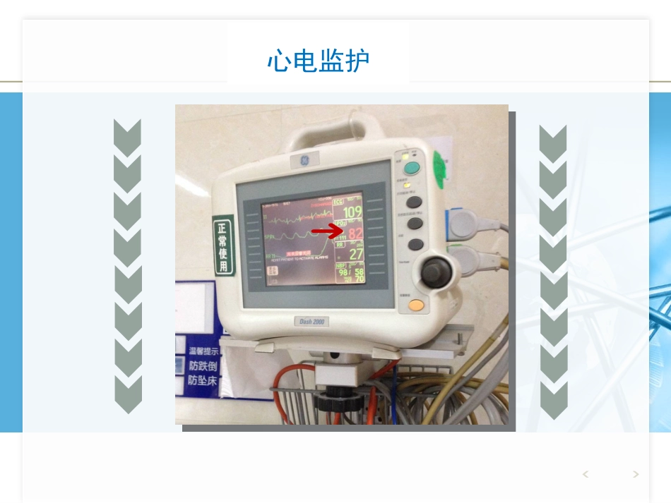 NPPV人机对抗个案护理_第5页