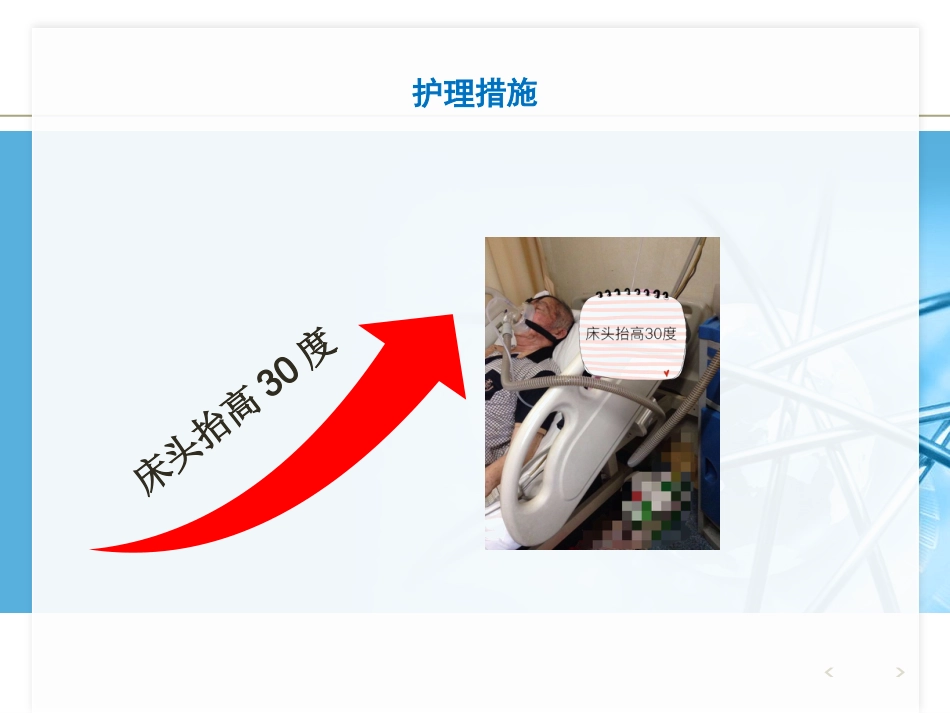 NPPV人机对抗个案护理_第8页
