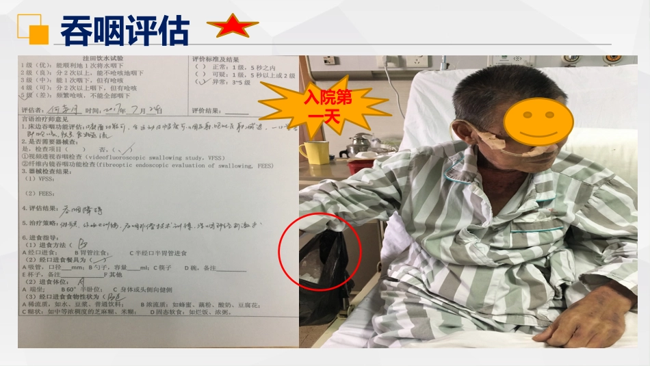 一例脑干梗塞并发真性球麻痹的个案护理_第13页