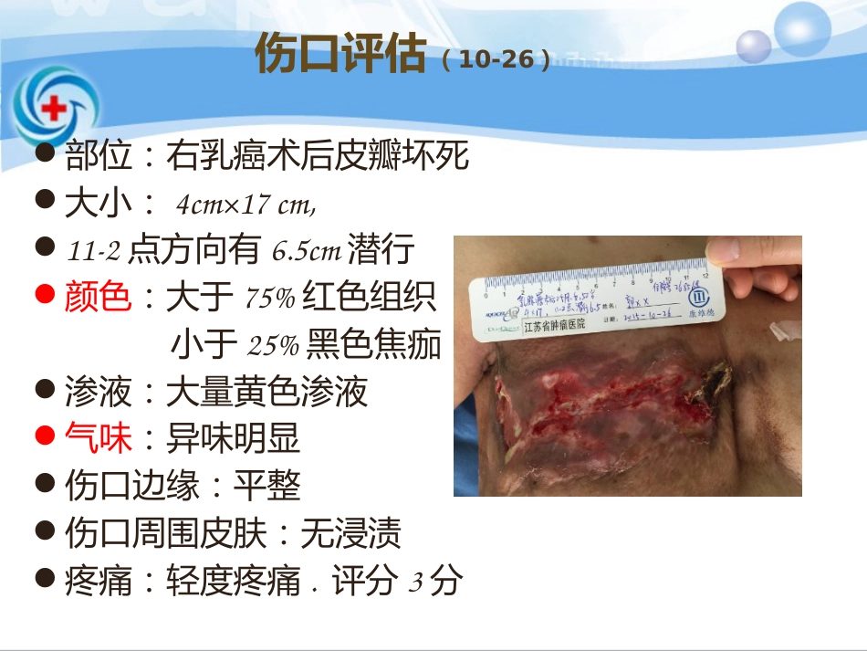一案乳腺癌术后皮瓣坏死患者的处理_第11页