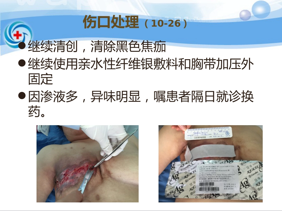 一案乳腺癌术后皮瓣坏死患者的处理_第12页
