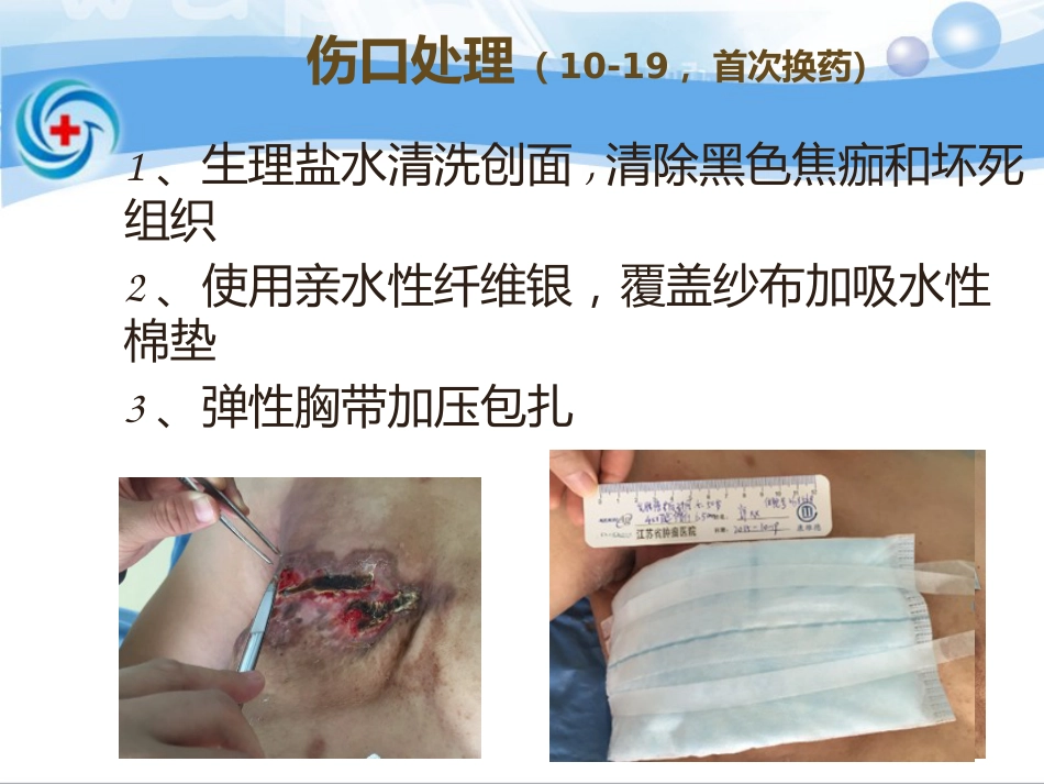 一案乳腺癌术后皮瓣坏死患者的处理_第9页