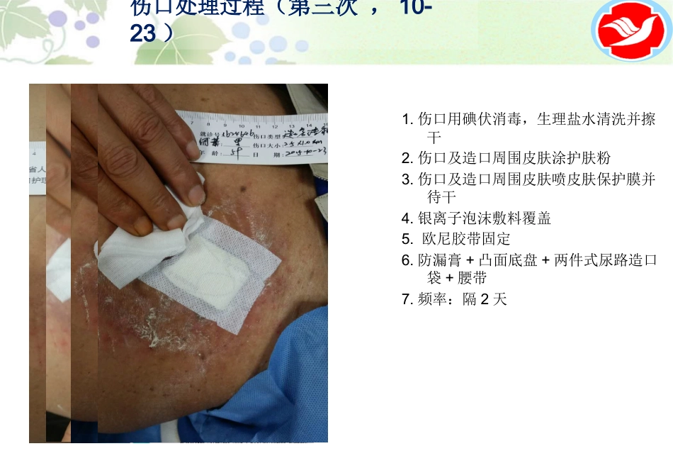 一例泌尿造口患者的护理_第12页