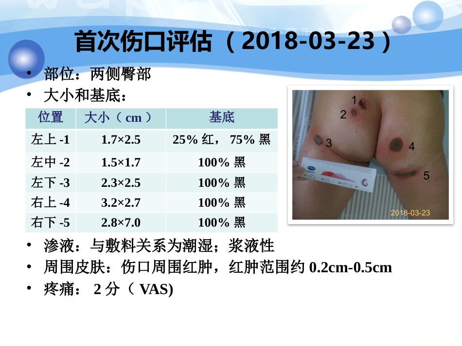 一例白塞病合并臀部溃疡患者的护理_第10页